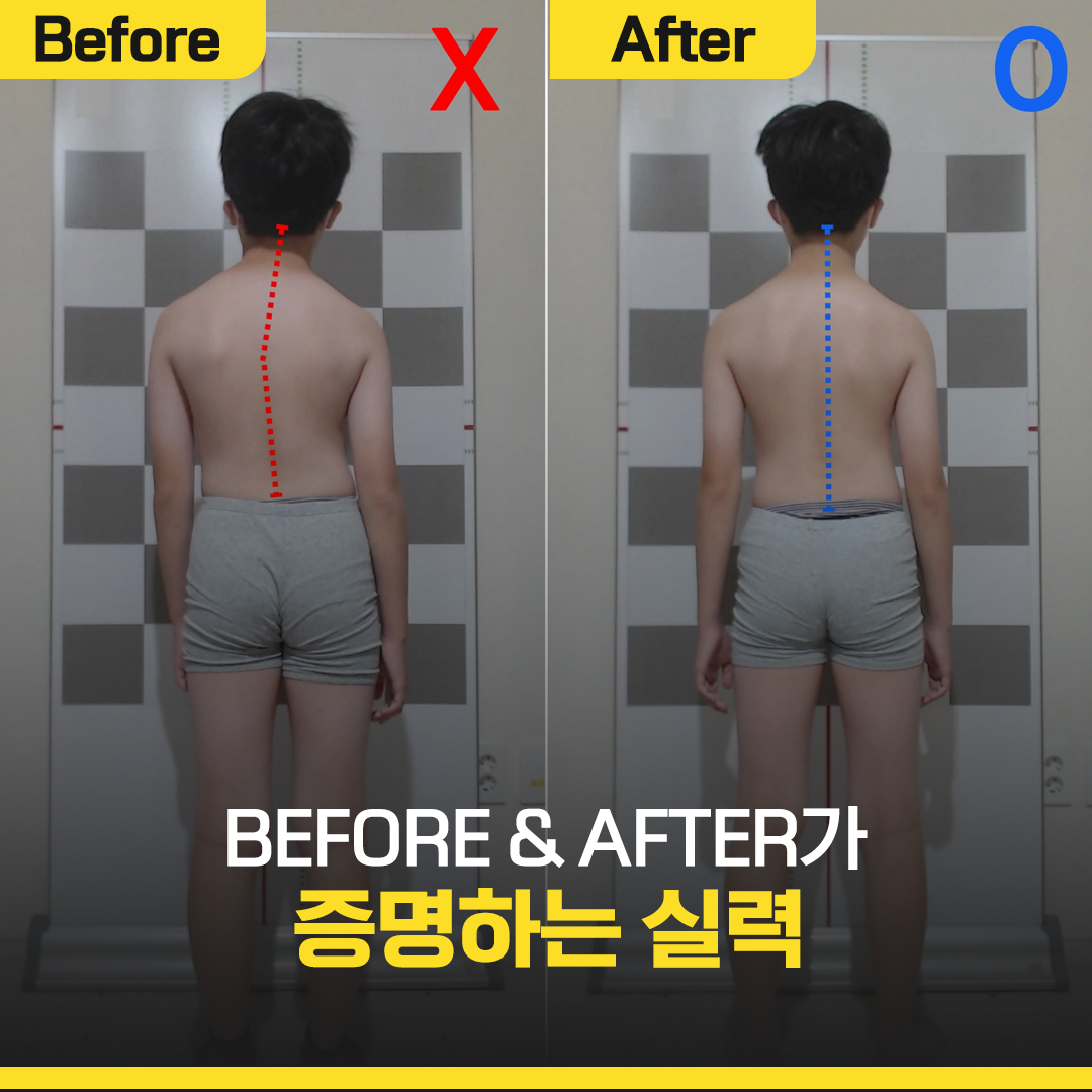 클래스바디 체형교정센터 분당서현점 photo 4