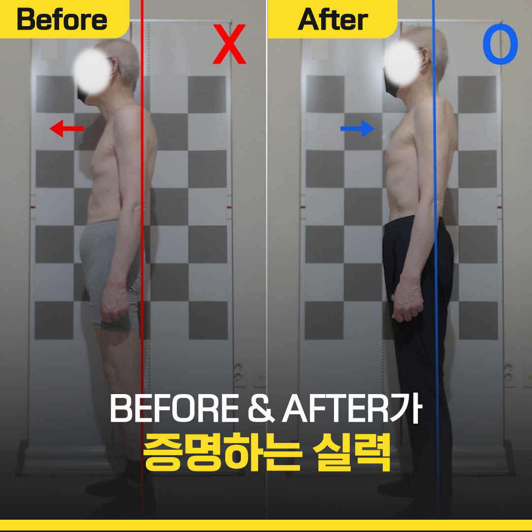 클래스바디 체형교정센터 분당서현점 photo 3