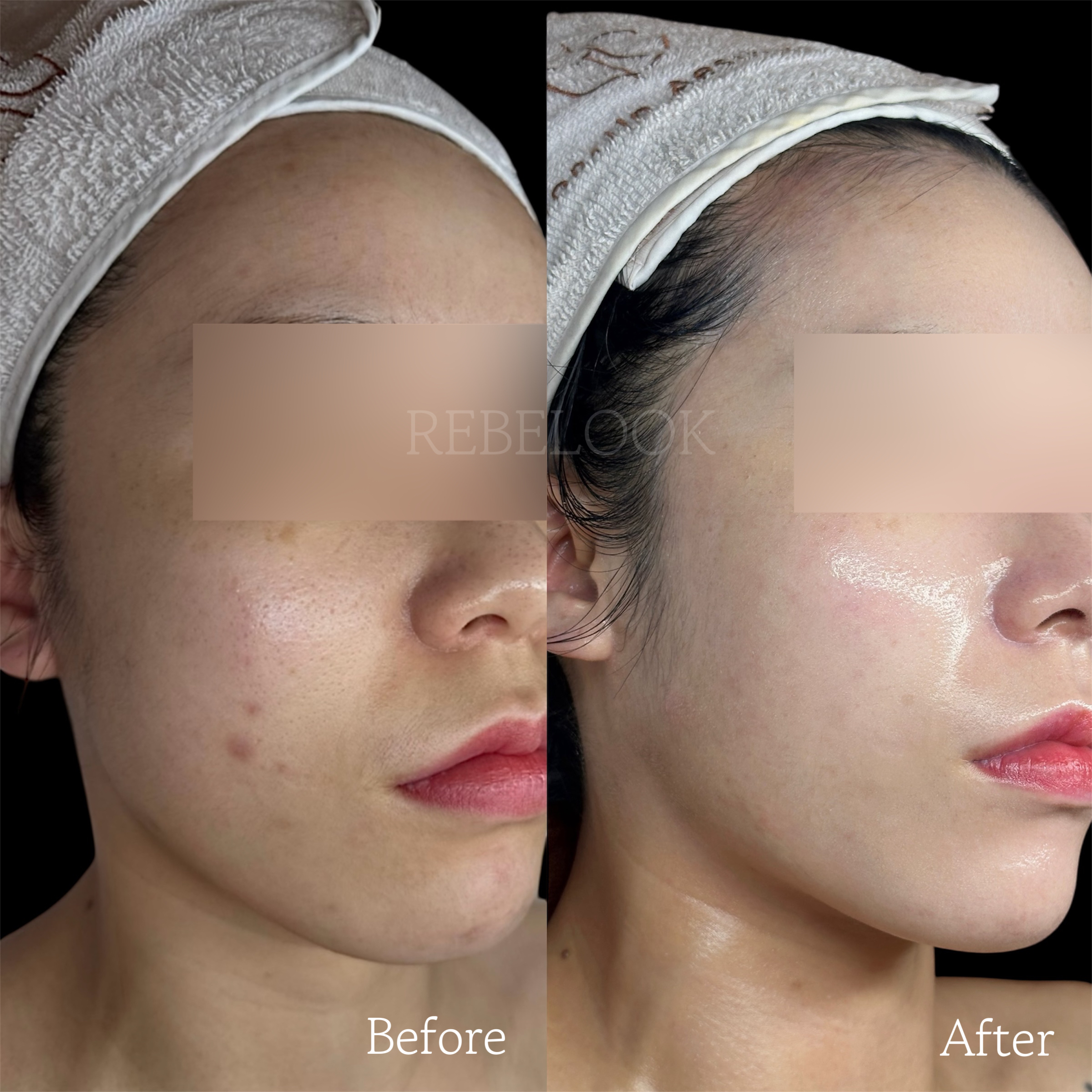 톤업에스테틱 대표 이미지