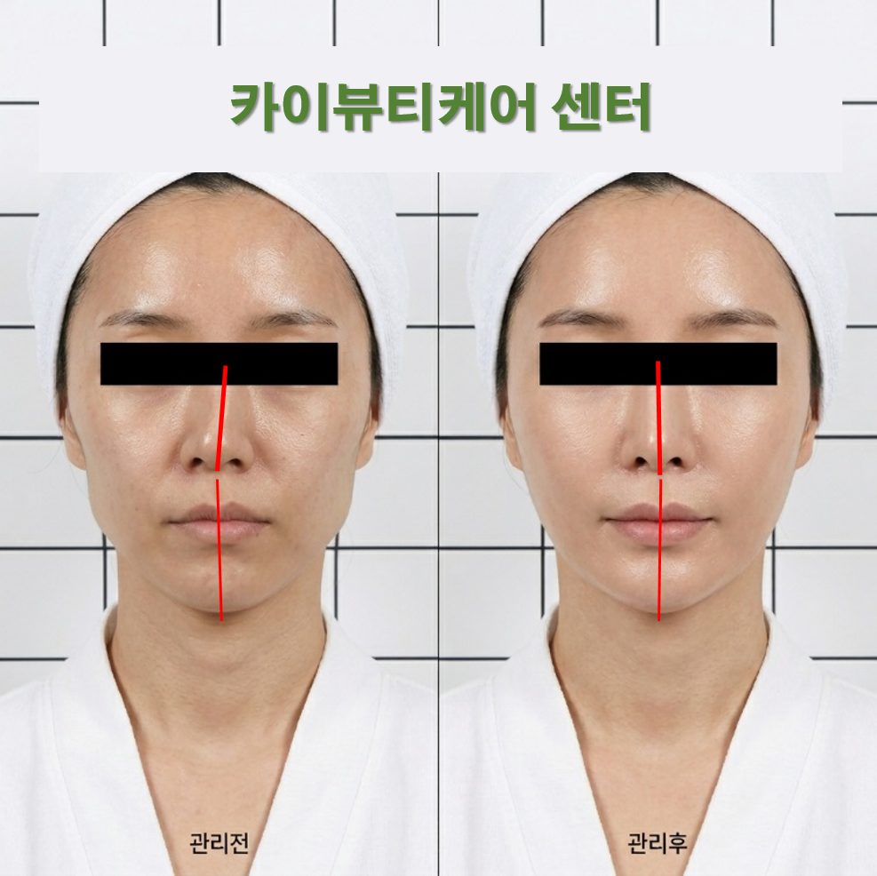 카이뷰티케어센터 인계본점 photo 10
