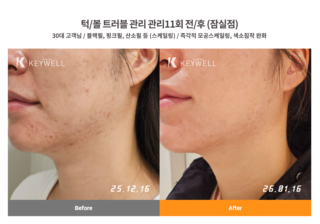 키웰 분당서현점 photo 9