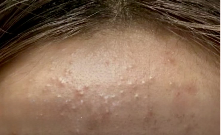 스킨플러스 대표 이미지