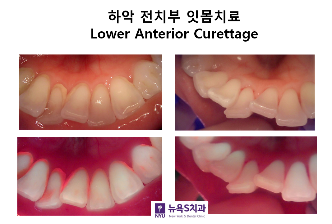 뉴욕S치과 이미지