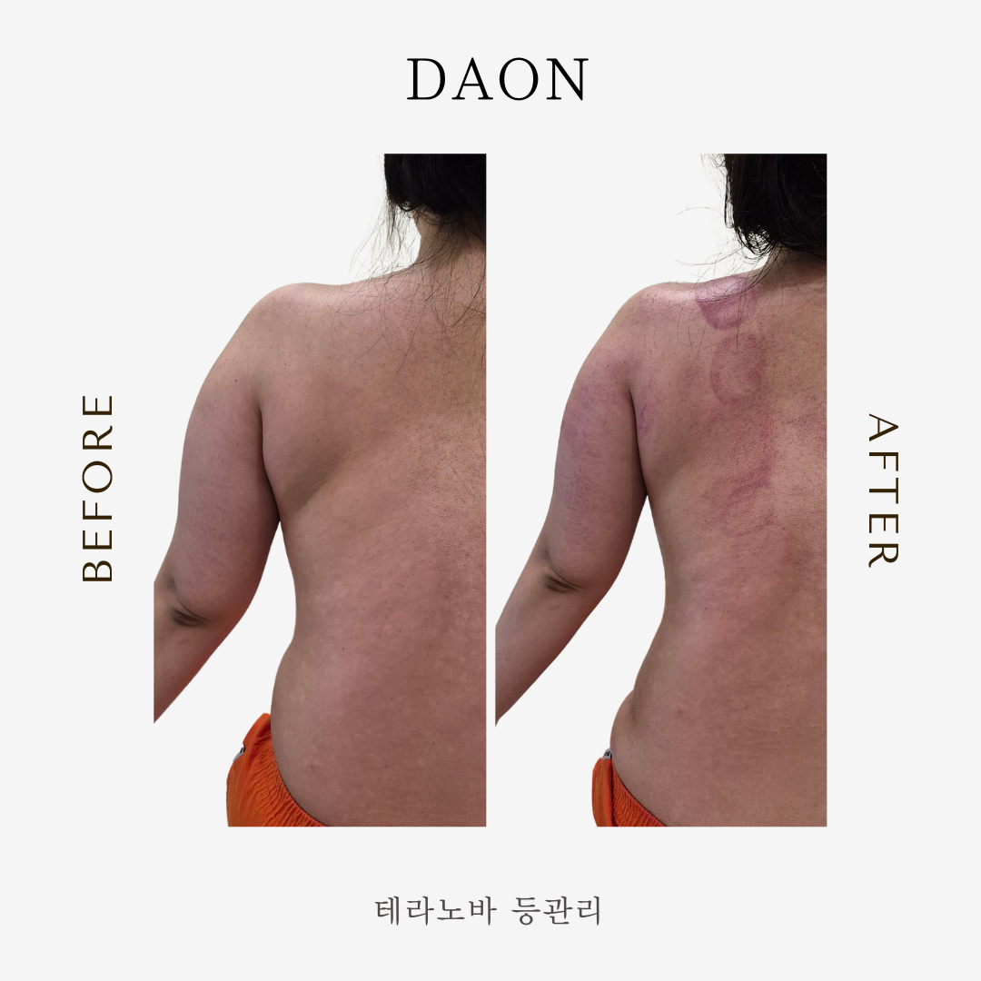 다온 마사지남양주센타 photo 5