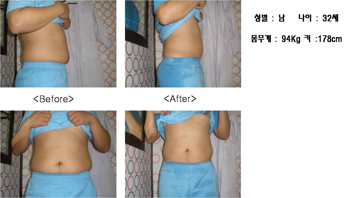 시흥능곡뷰티케이 photo 7