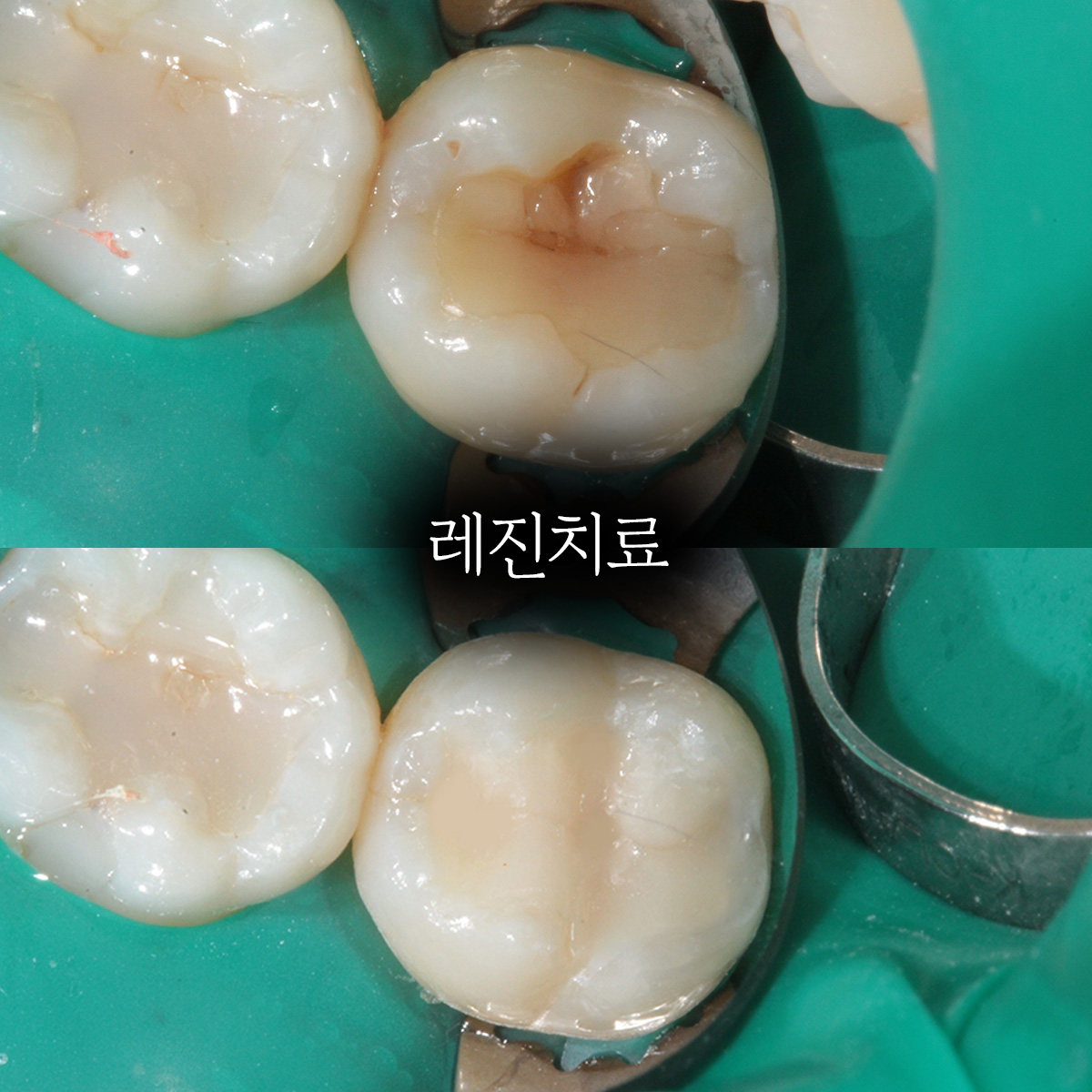 세이지치과의원 대표 이미지