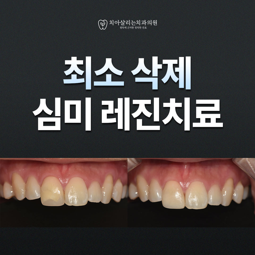 치아살리는치과의원 대표 이미지
