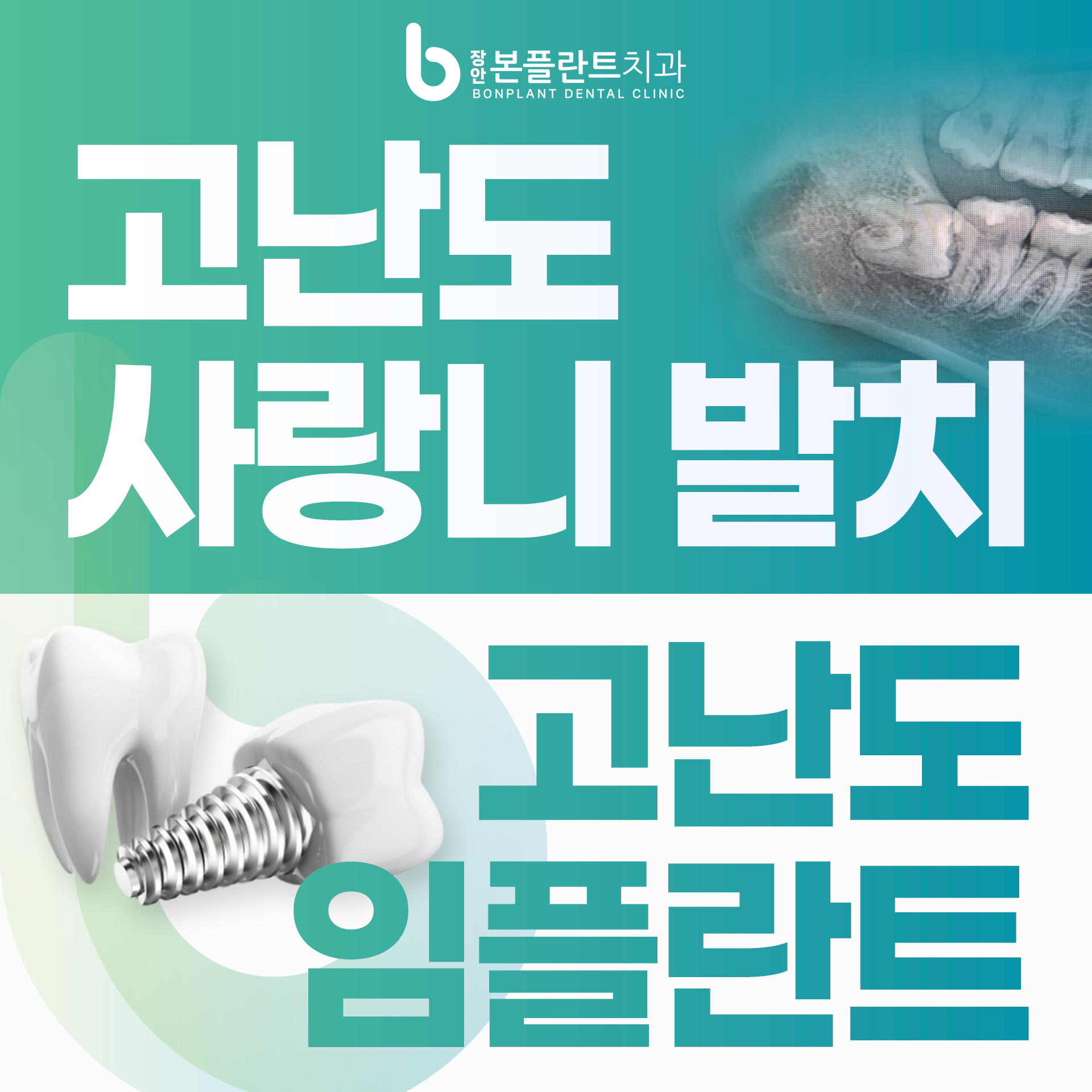 장안본플란트치과의원 대표 이미지