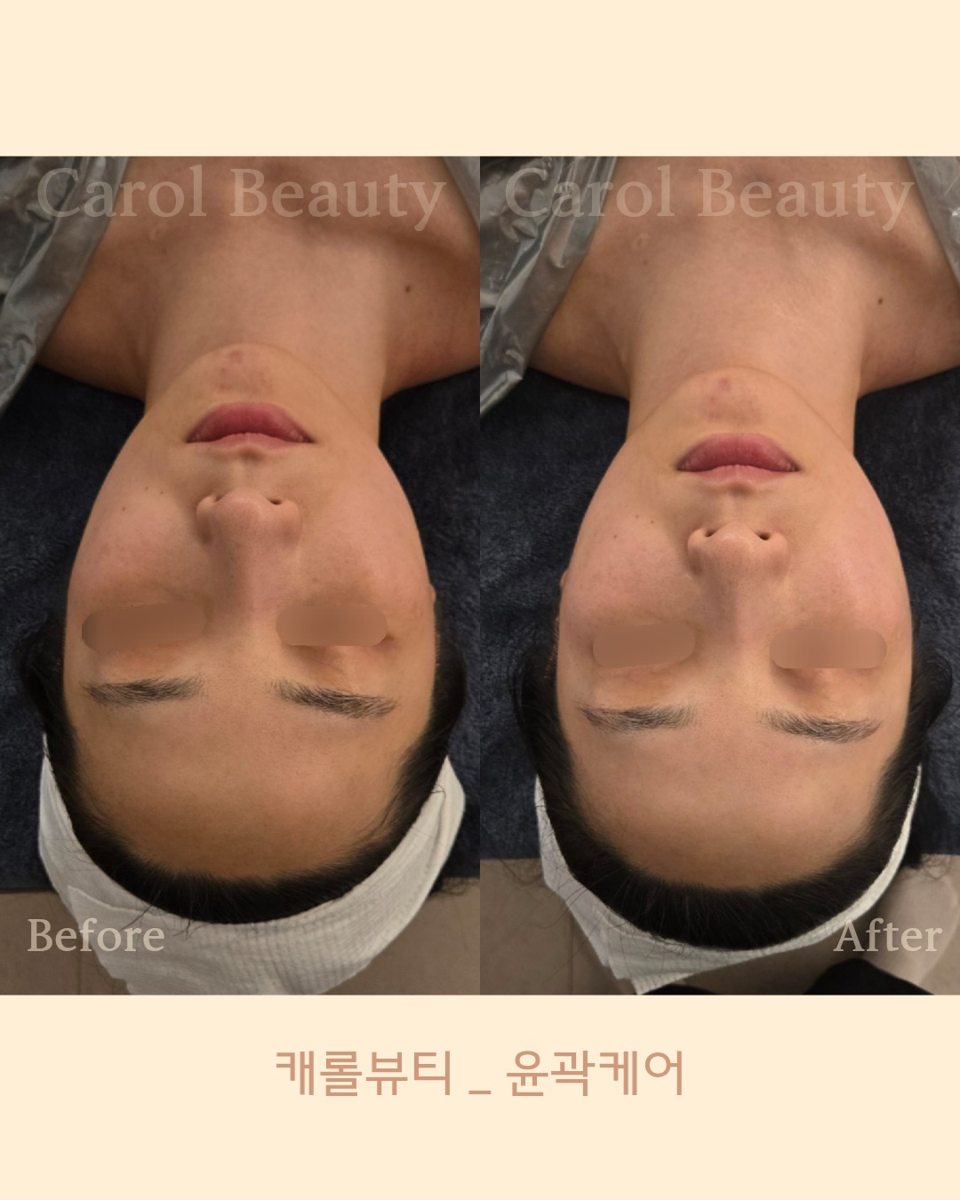 캐롤뷰티 photo 4