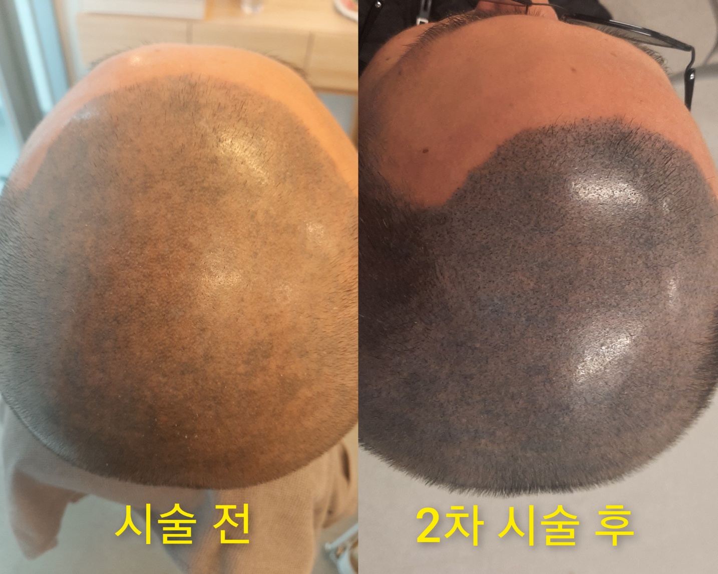 숲칼프 가산두피탈모전문센터 photo 4