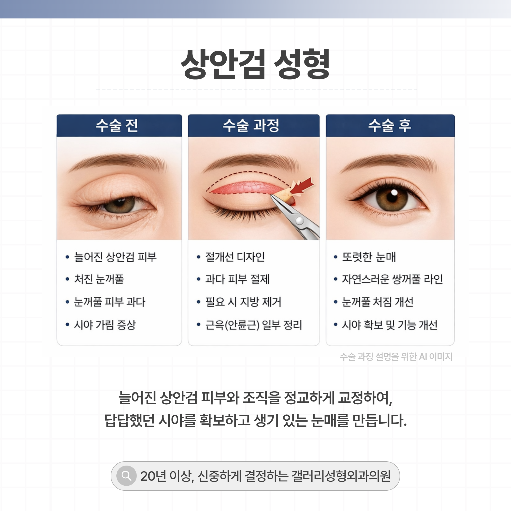 갤러리성형외과