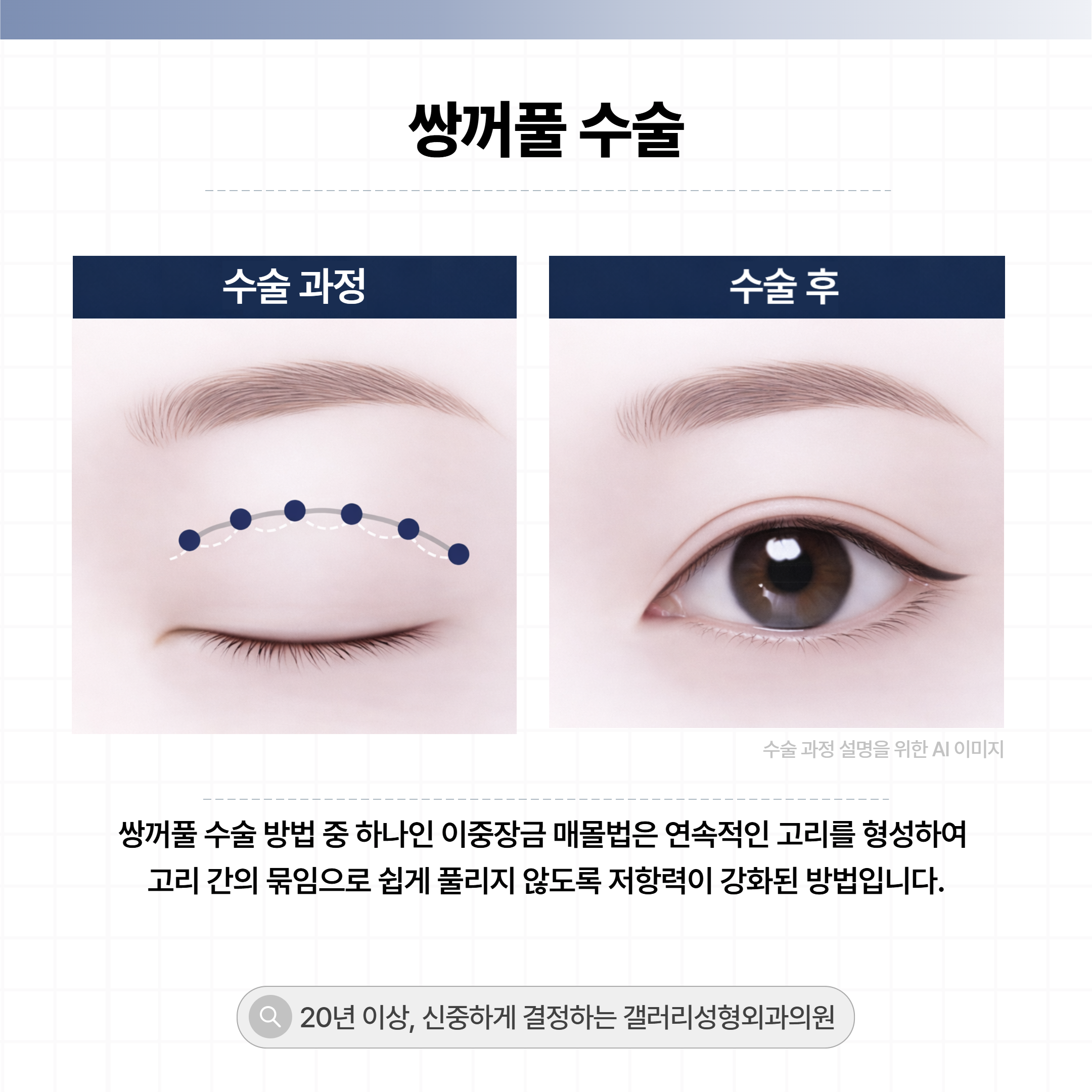 갤러리성형외과의원 대표 이미지