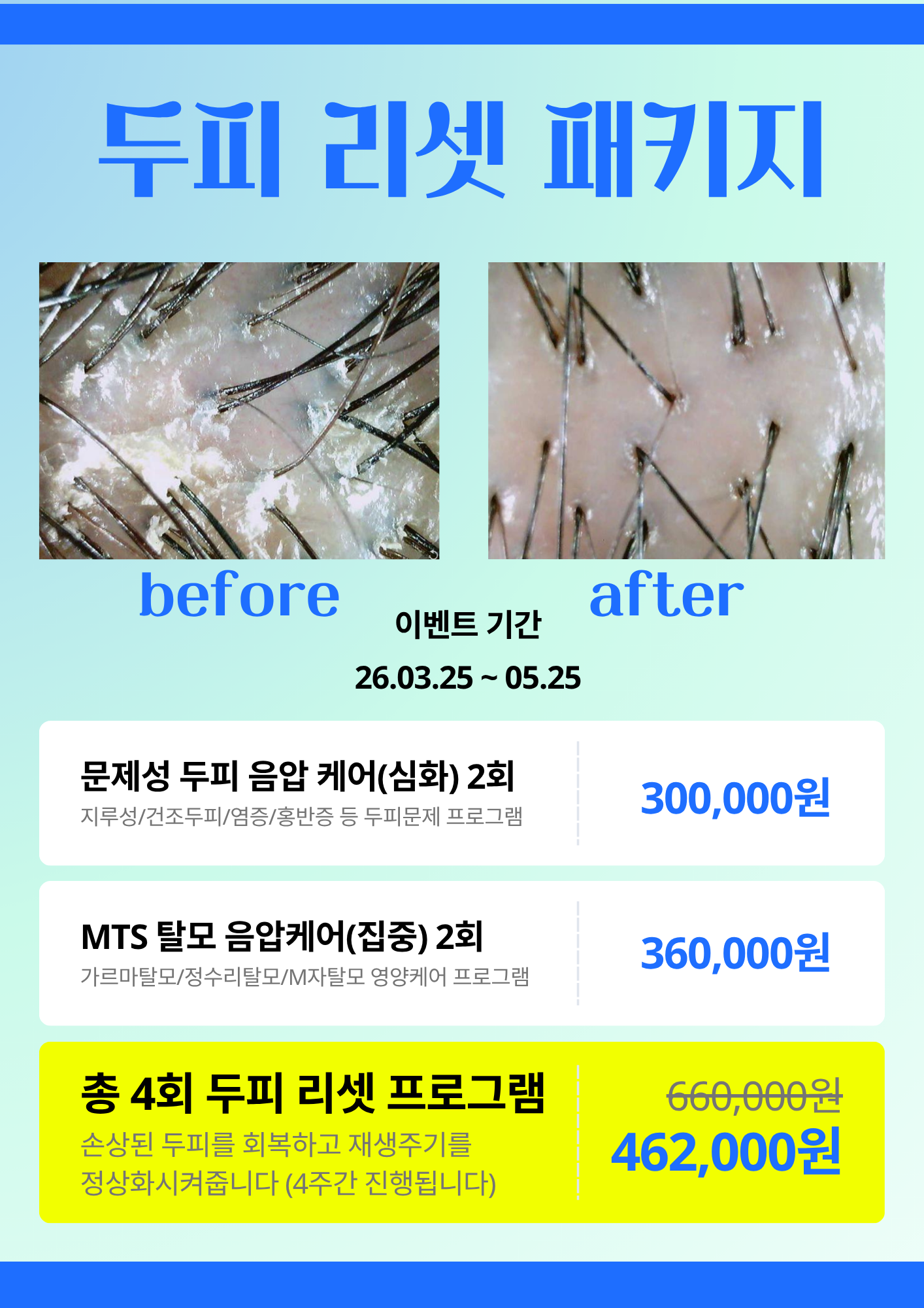 현스칼프 대표 이미지