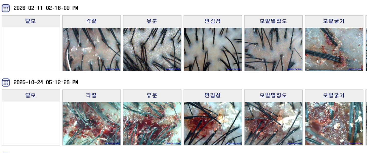 배럴스두피탈모센터 이미지