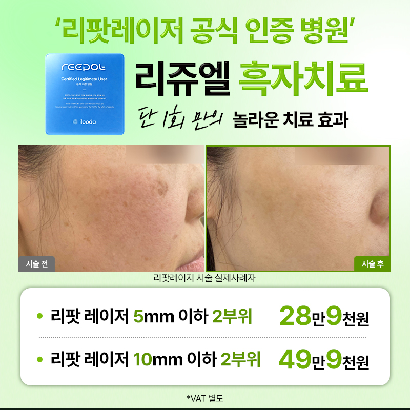 리쥬엘의원 수성 대표 이미지
