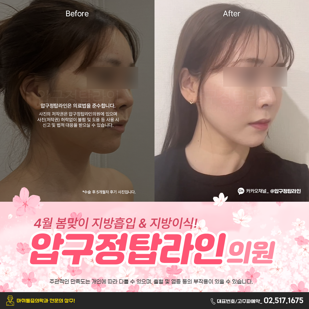 압구정탑라인의원 대표 이미지