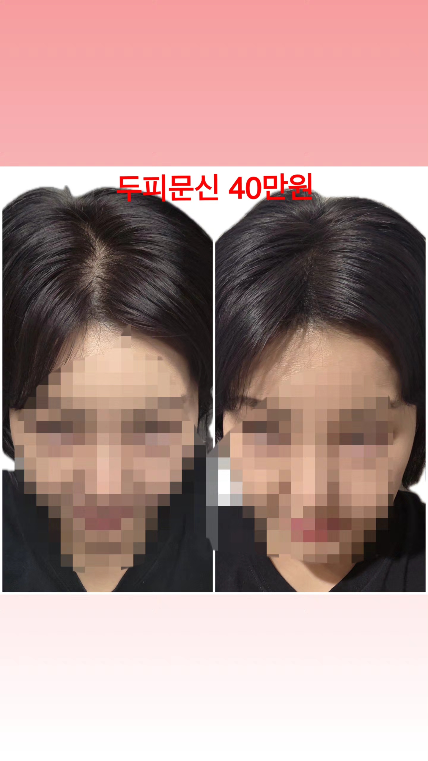 여우스파 photo 8