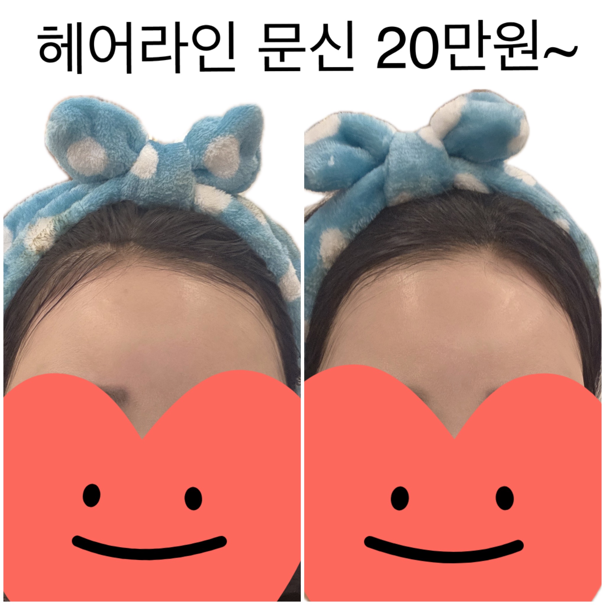 여우스파 photo 9