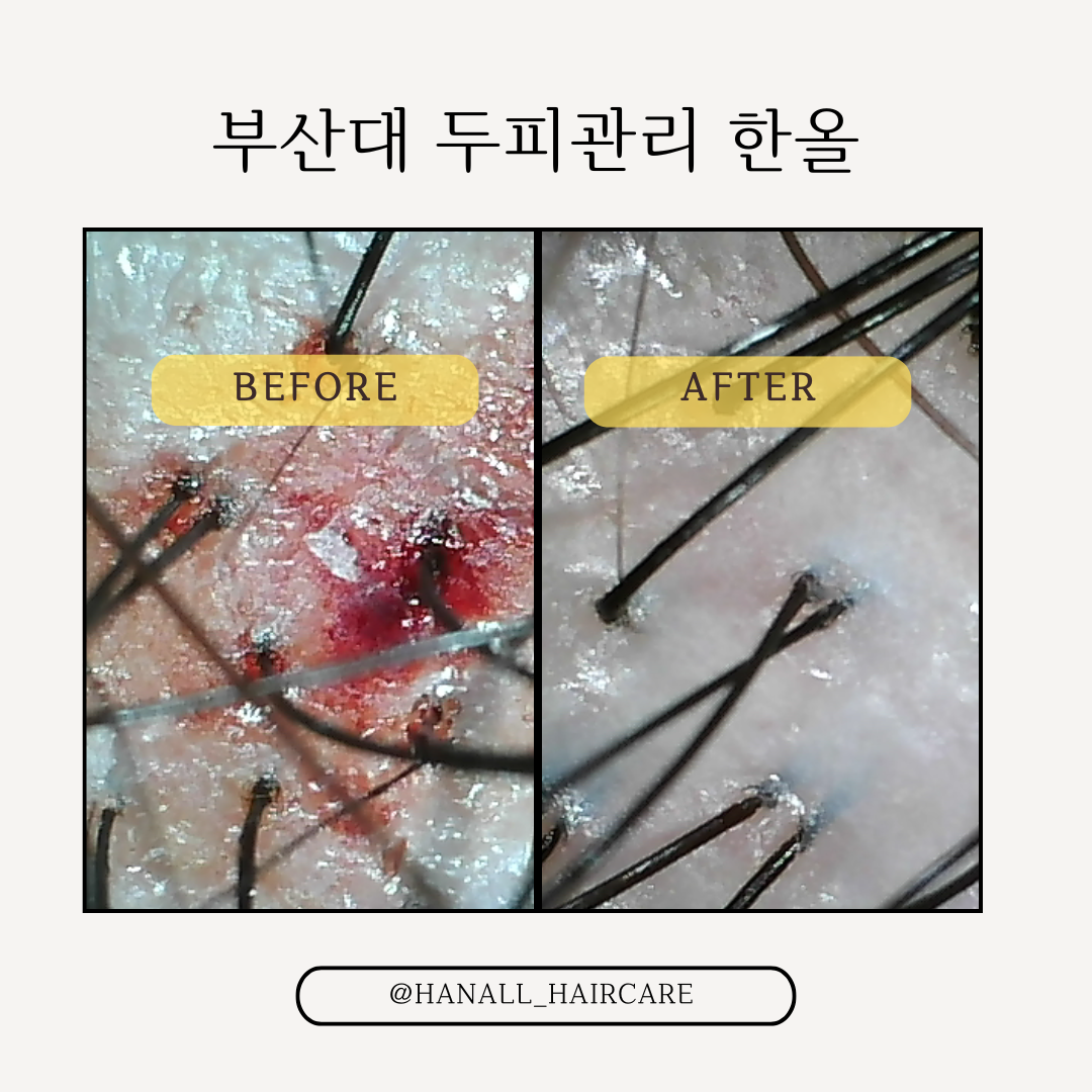 한올 대표 이미지