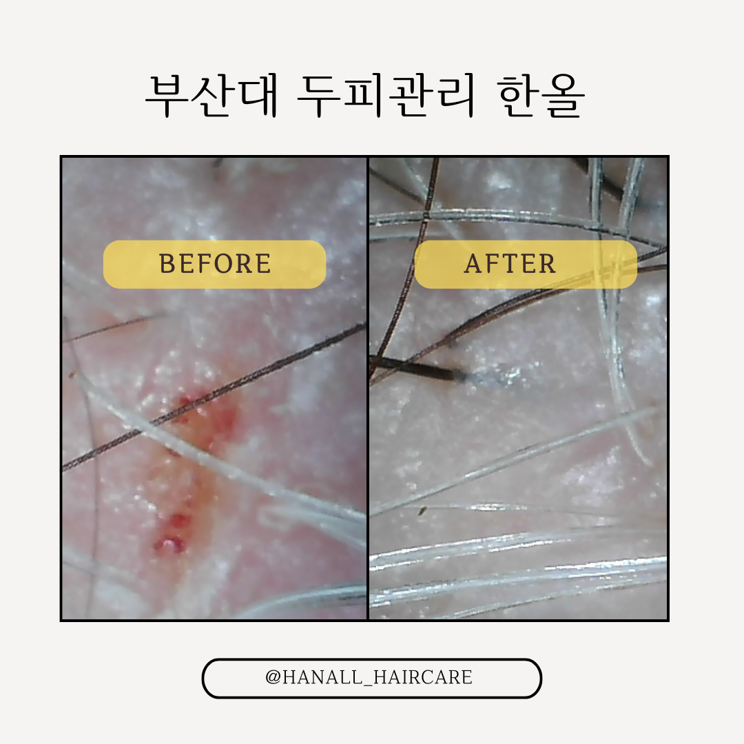 한올 photo 7