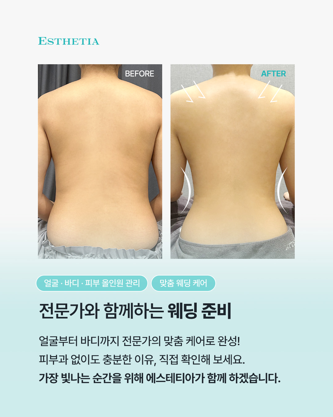 에스테티아 천안신불당1호점 photo 4