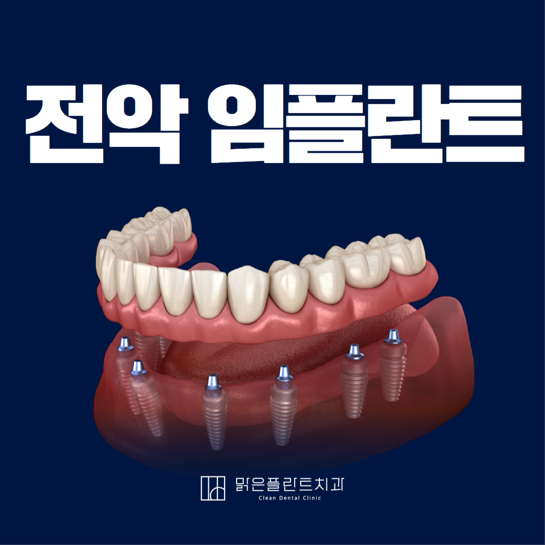 맑은플란트치과의원 안산점 사진 2