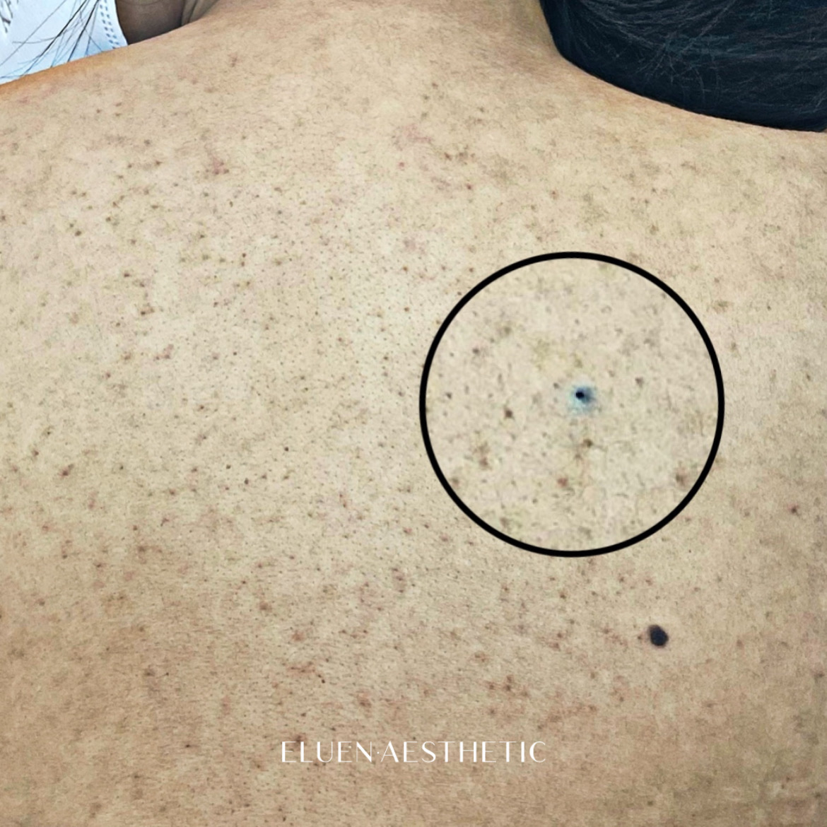 엘루엔에스테틱 대표 이미지