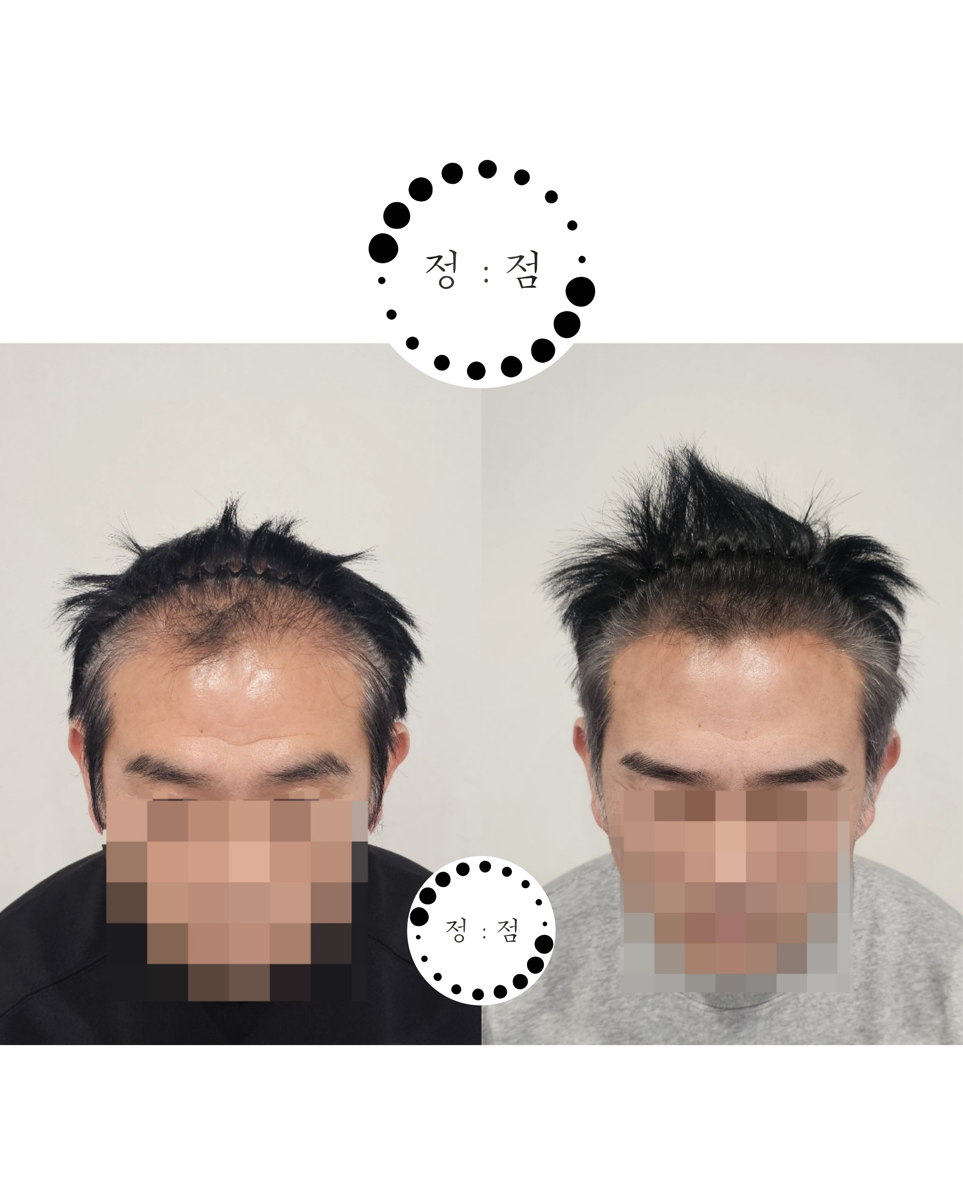 정점 대표 이미지