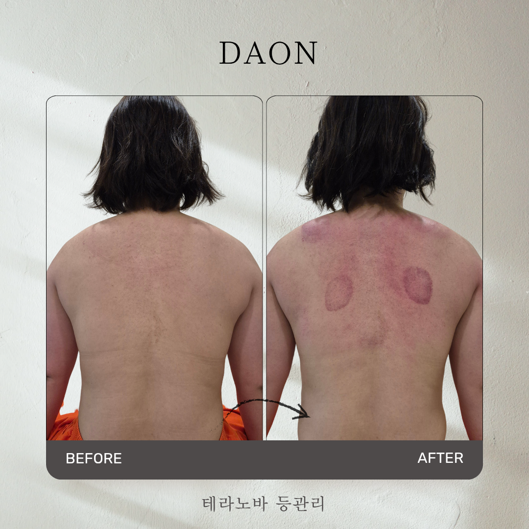 다온 마사지남양주센타 photo 3