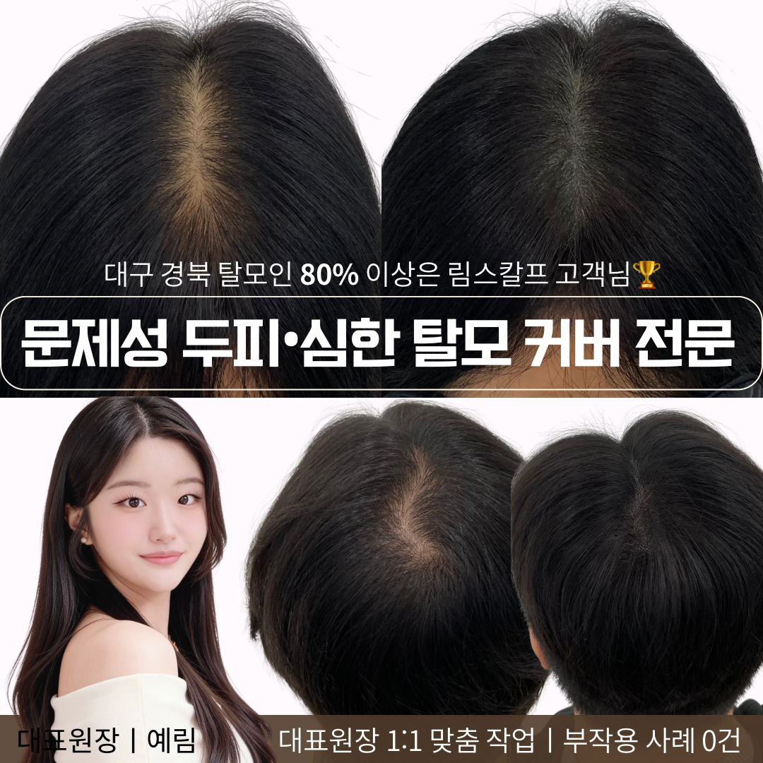 림스칼프 대표 이미지