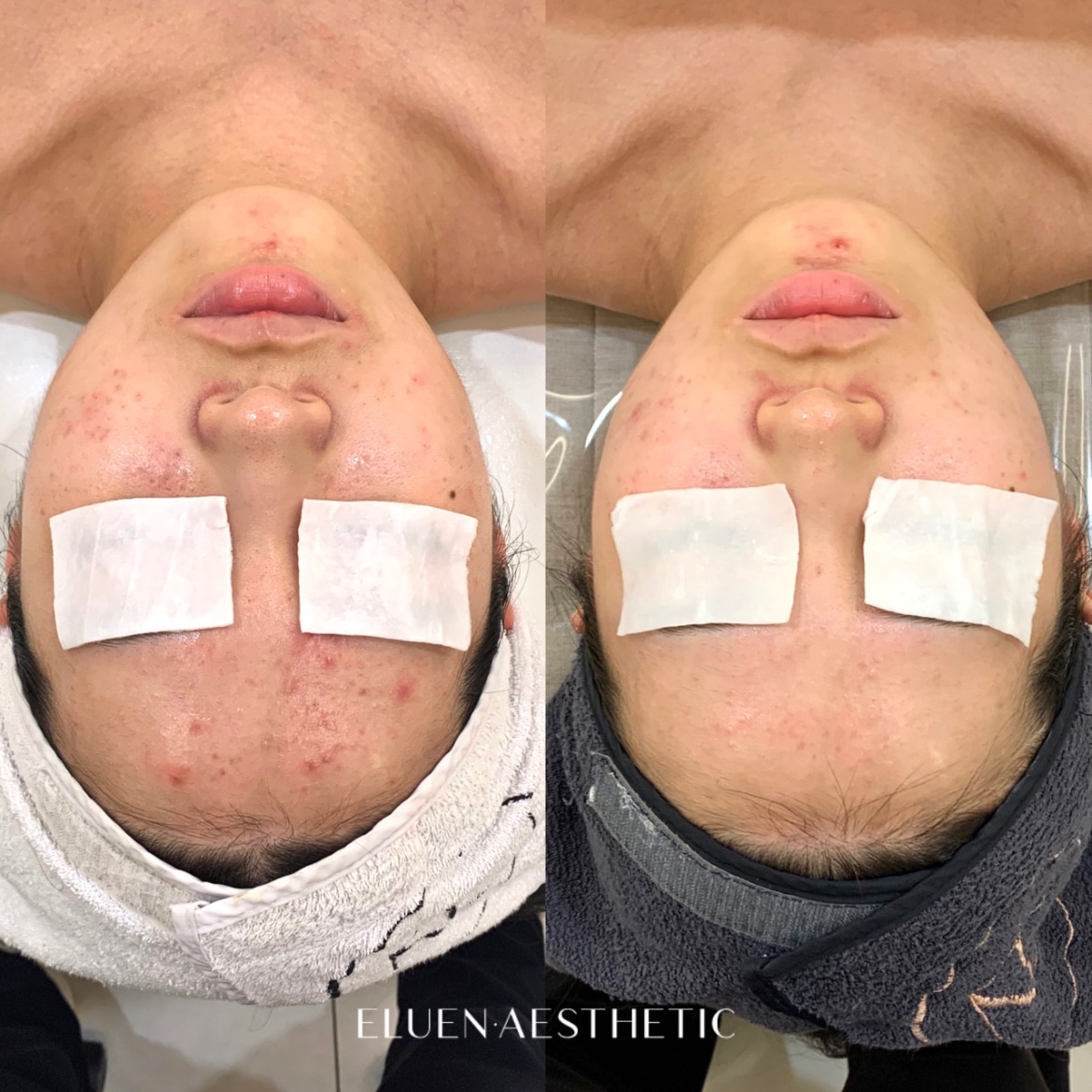 엘루엔에스테틱 대표 이미지