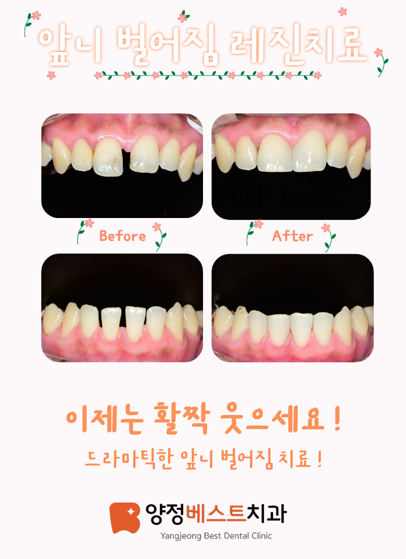 양정베스트치과의원 대표 이미지
