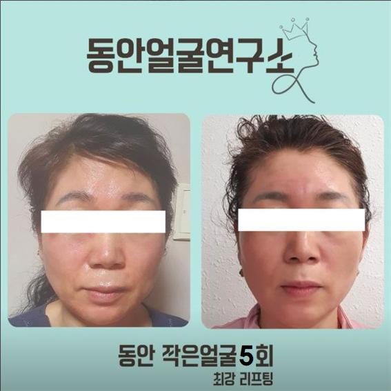 동안얼굴연구소 photo 7