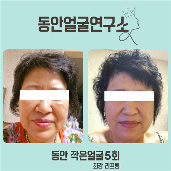 동안얼굴연구소 photo 8