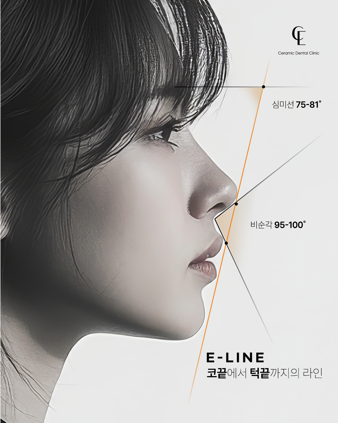 세라믹치과의원 대표 이미지