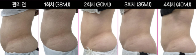 시흥능곡뷰티케이 photo 3