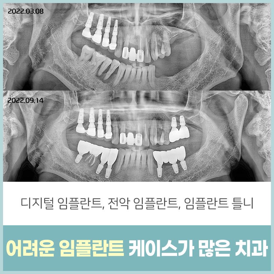 하남리더스치과 대표 이미지