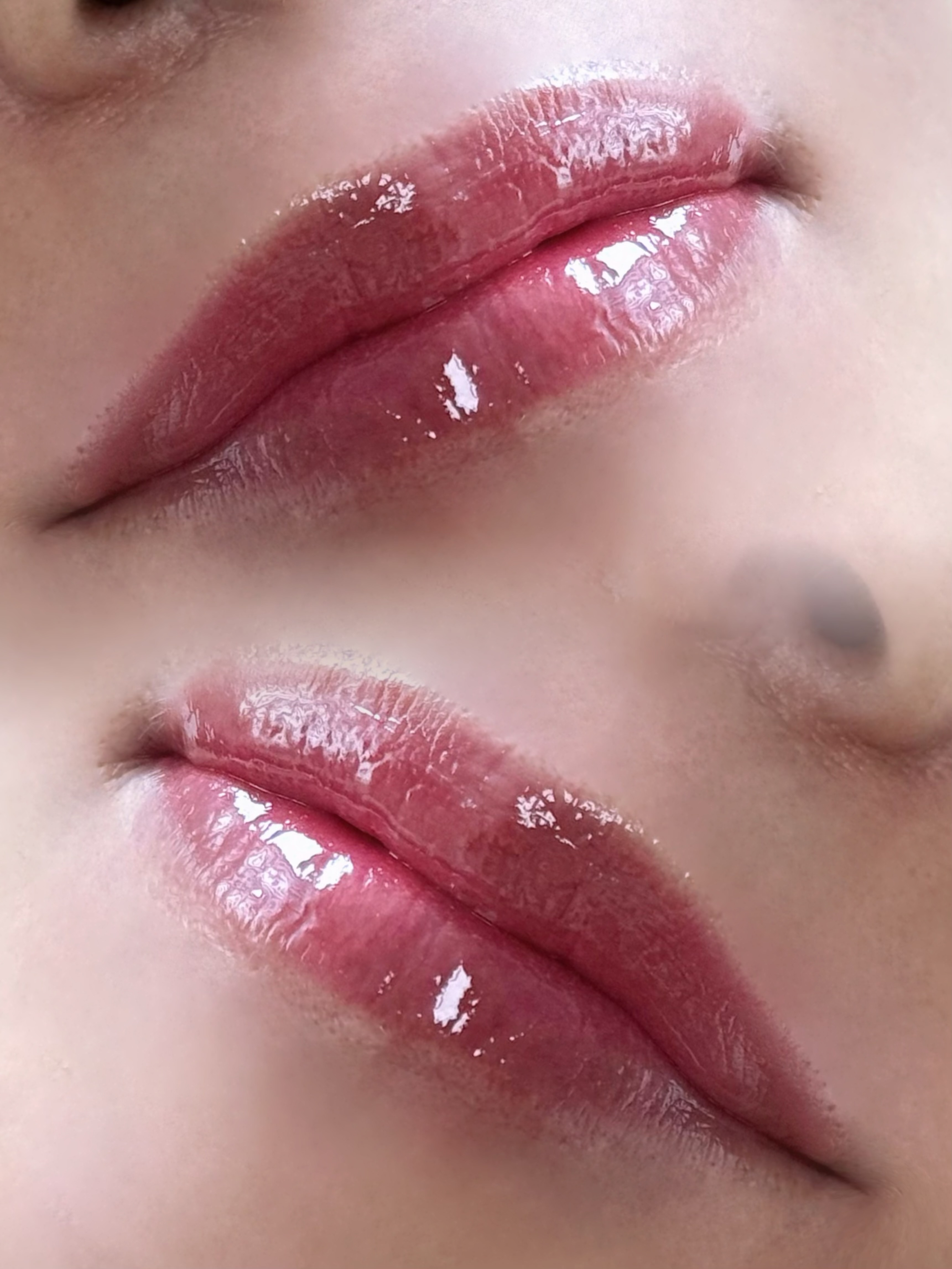 리메아 대표 이미지
