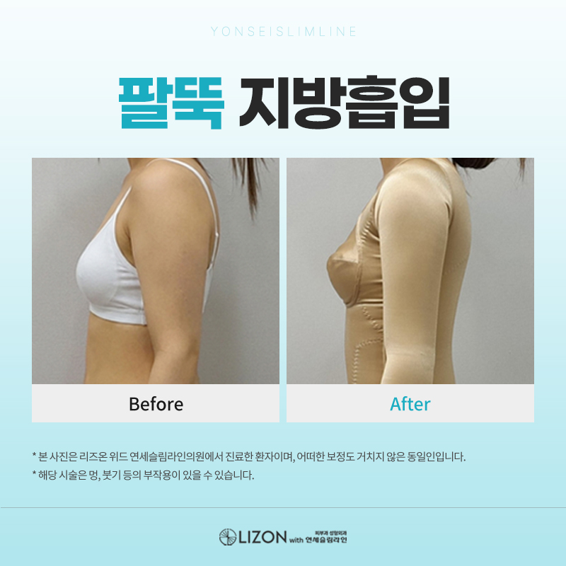 리즈온 위드 연세슬림라인의원 대표 이미지