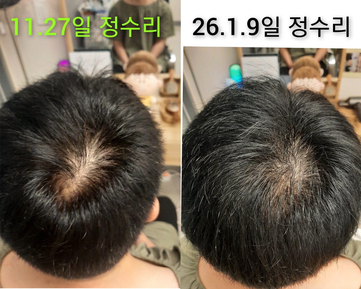 숲칼프 가산두피탈모전문센터 photo 6