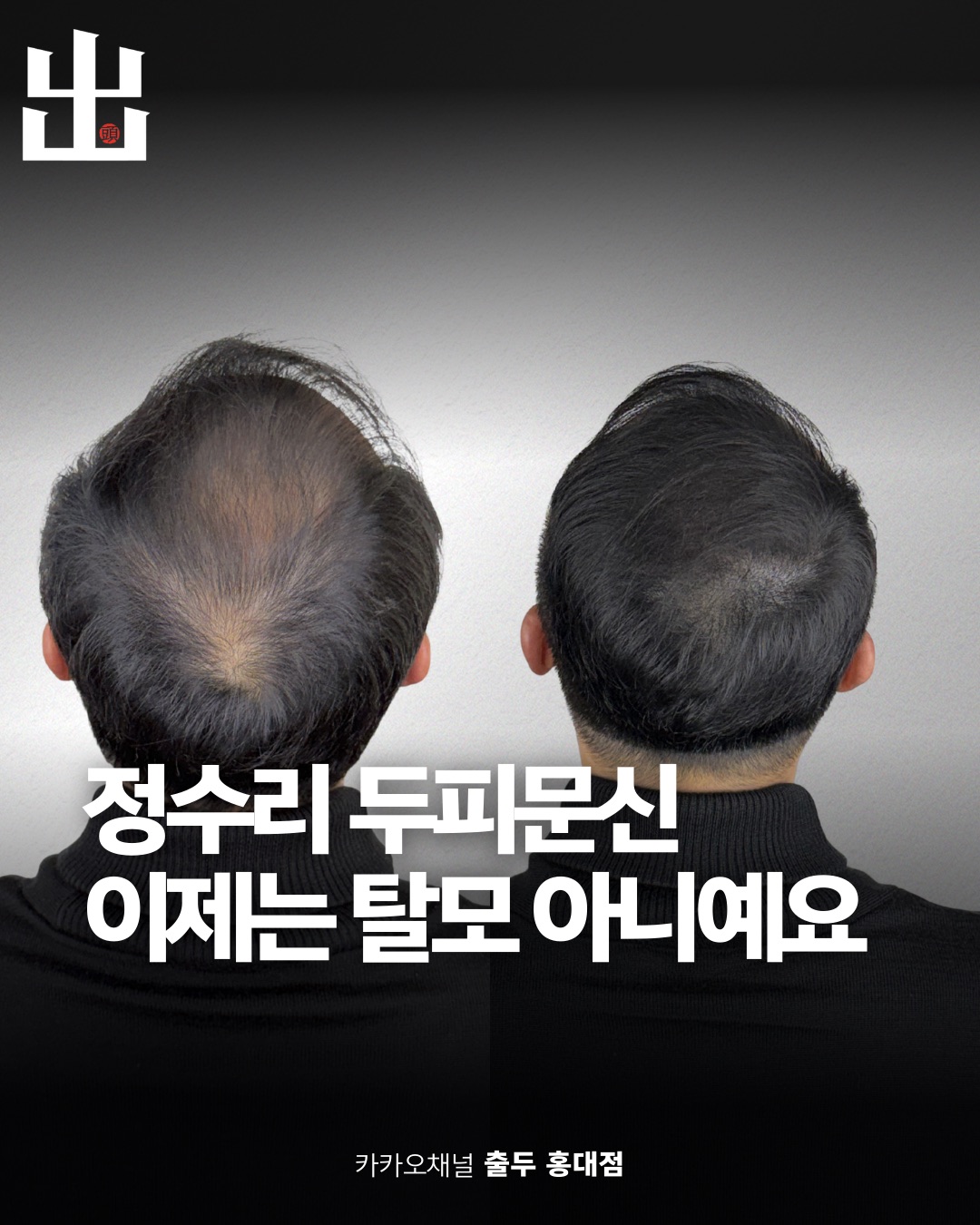 출두SMP 홍대점 대표 이미지
