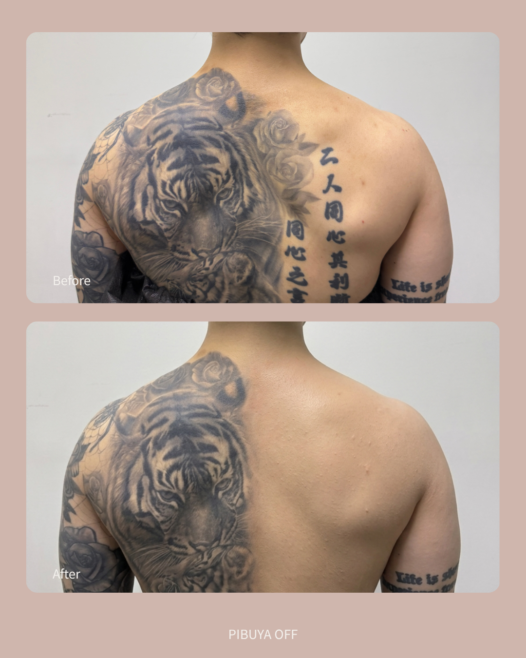 피부야 photo 3