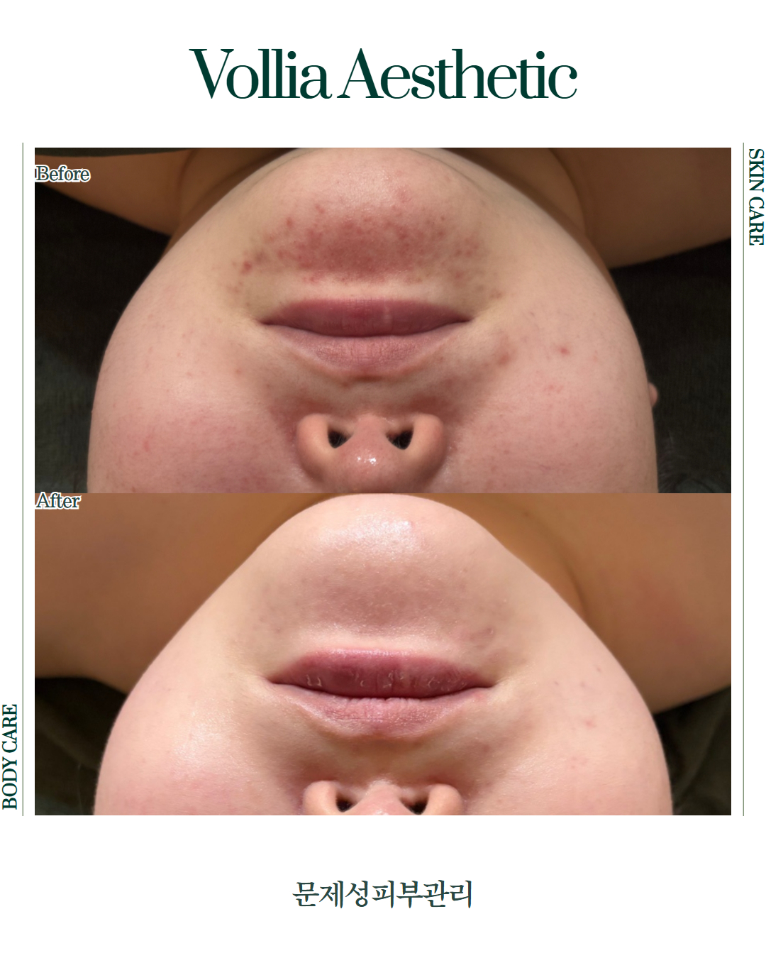 볼리아 에스테틱 대표 이미지