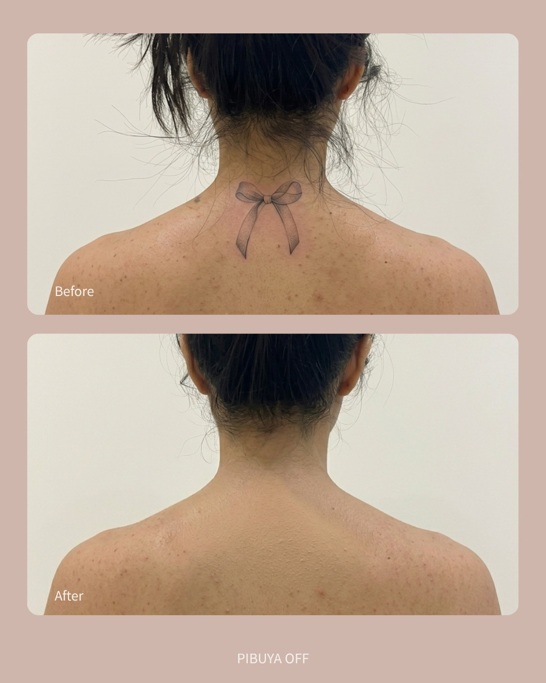 피부야 photo 2