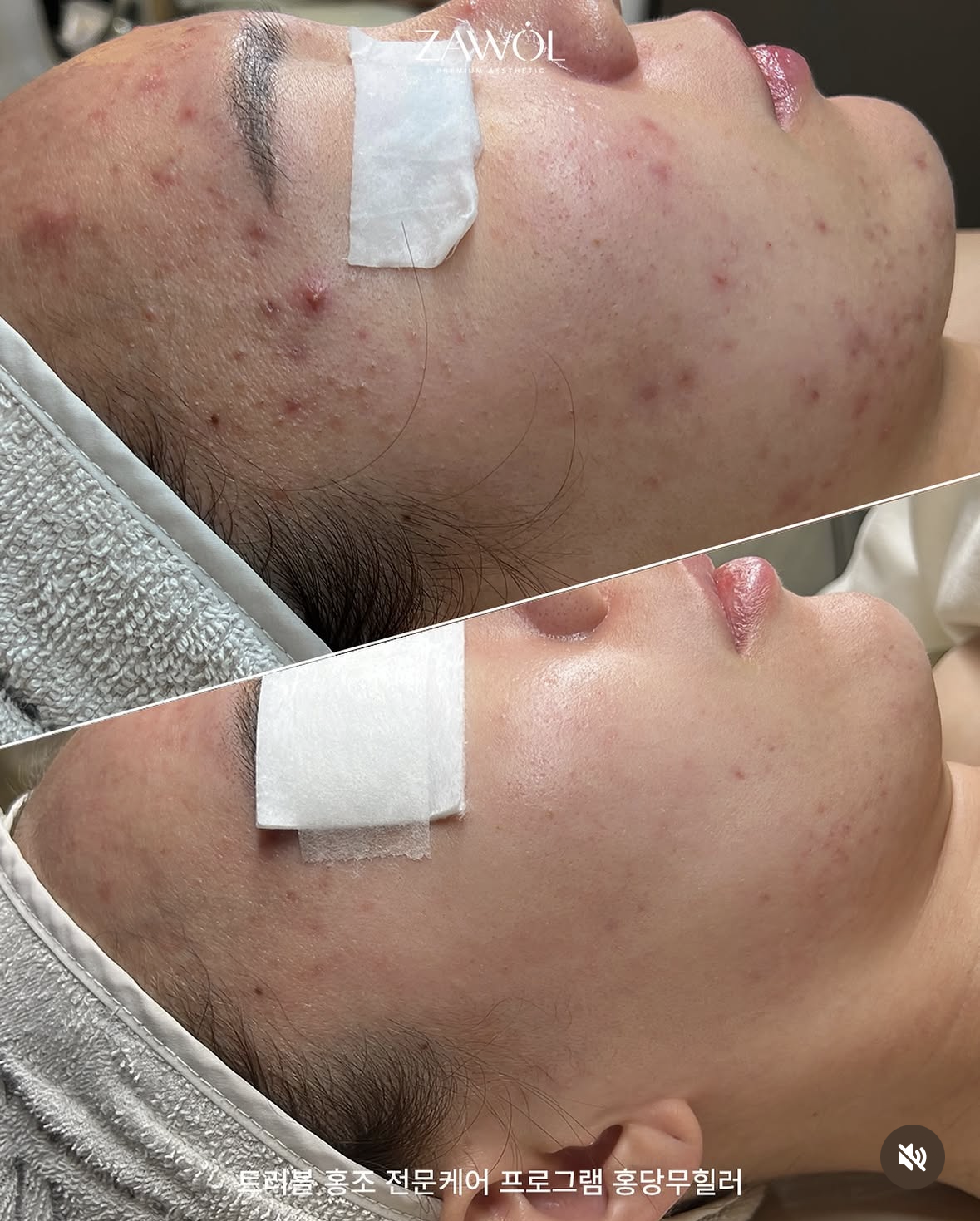 자월에스테틱 대표 이미지