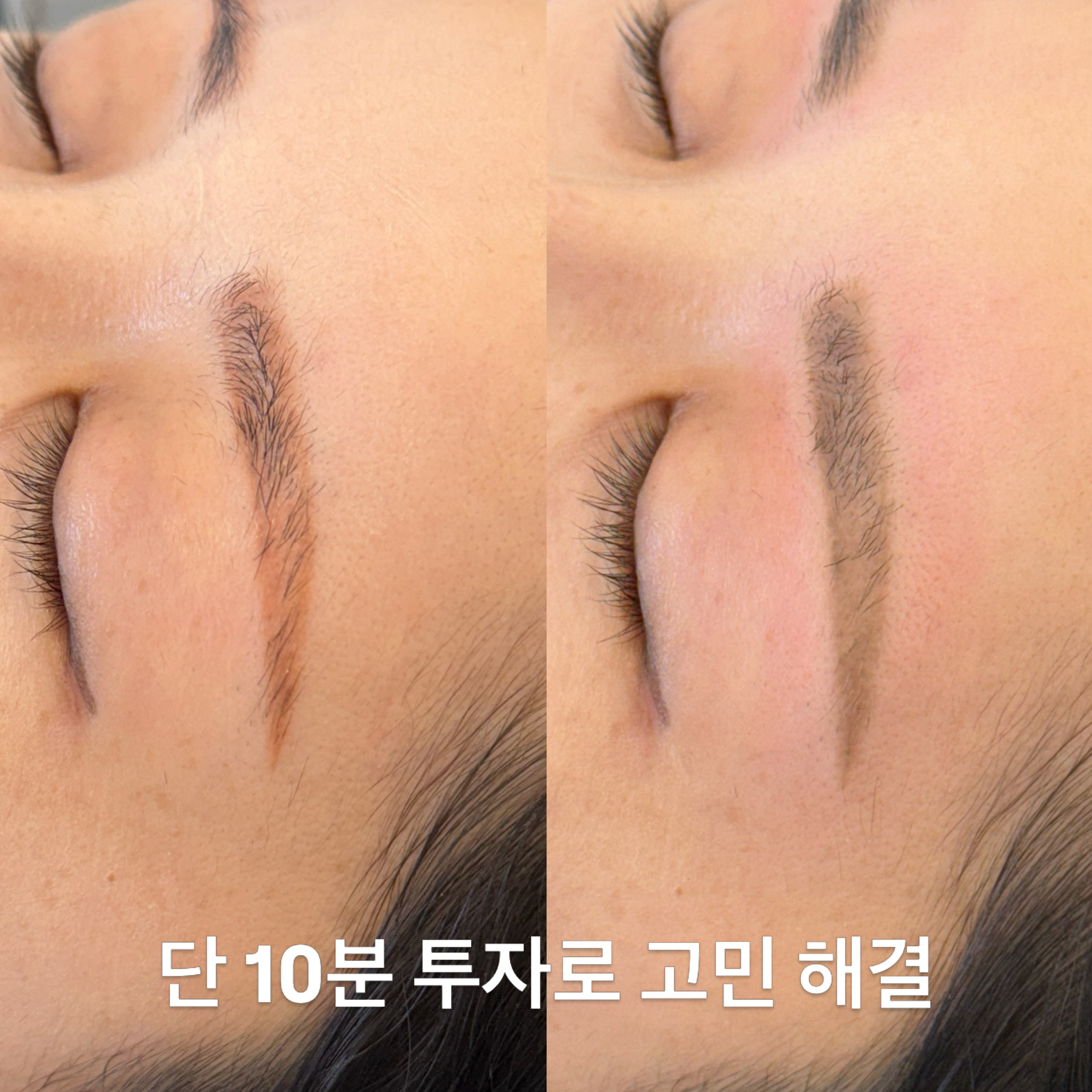 내안에뷰티 헤드스파&왁싱 photo 9