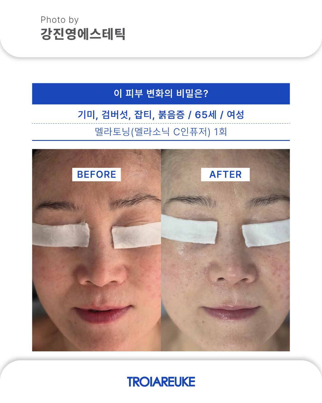 강진영에스테틱 대표 이미지