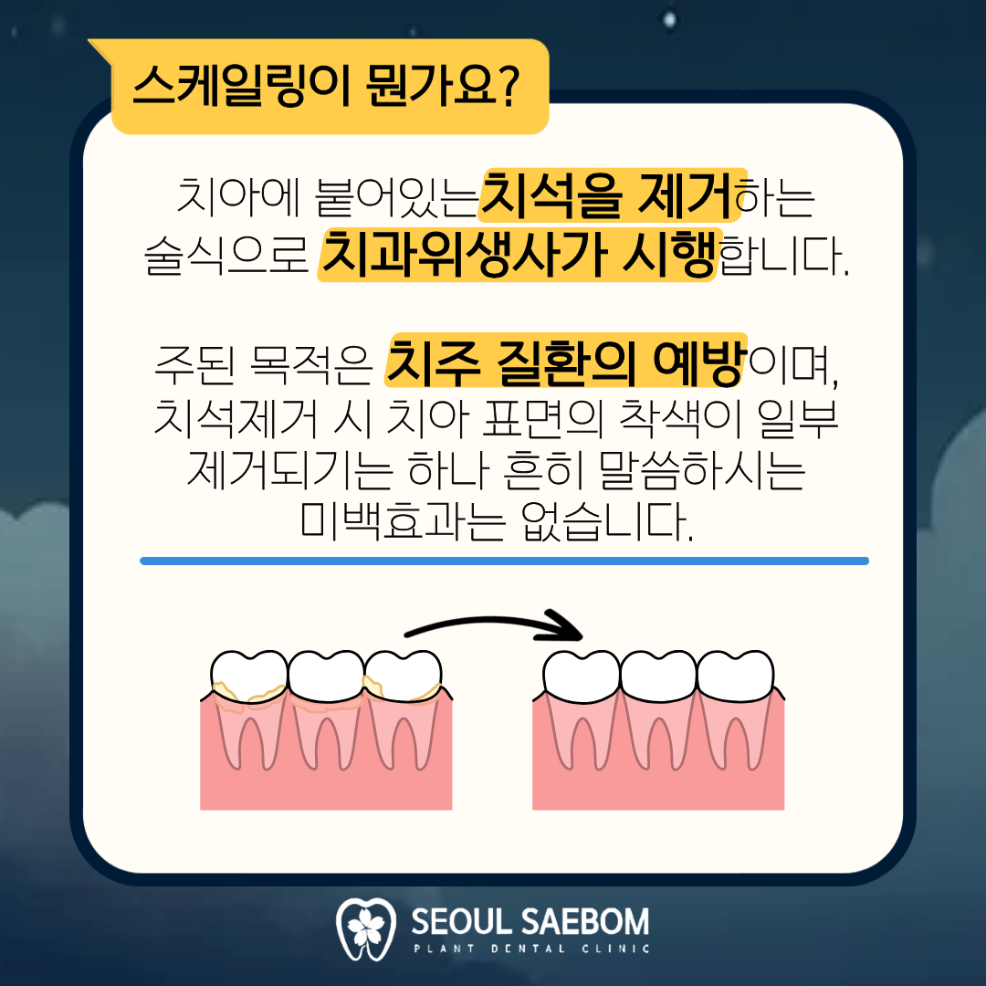 서울새봄플란트치과 대표 이미지