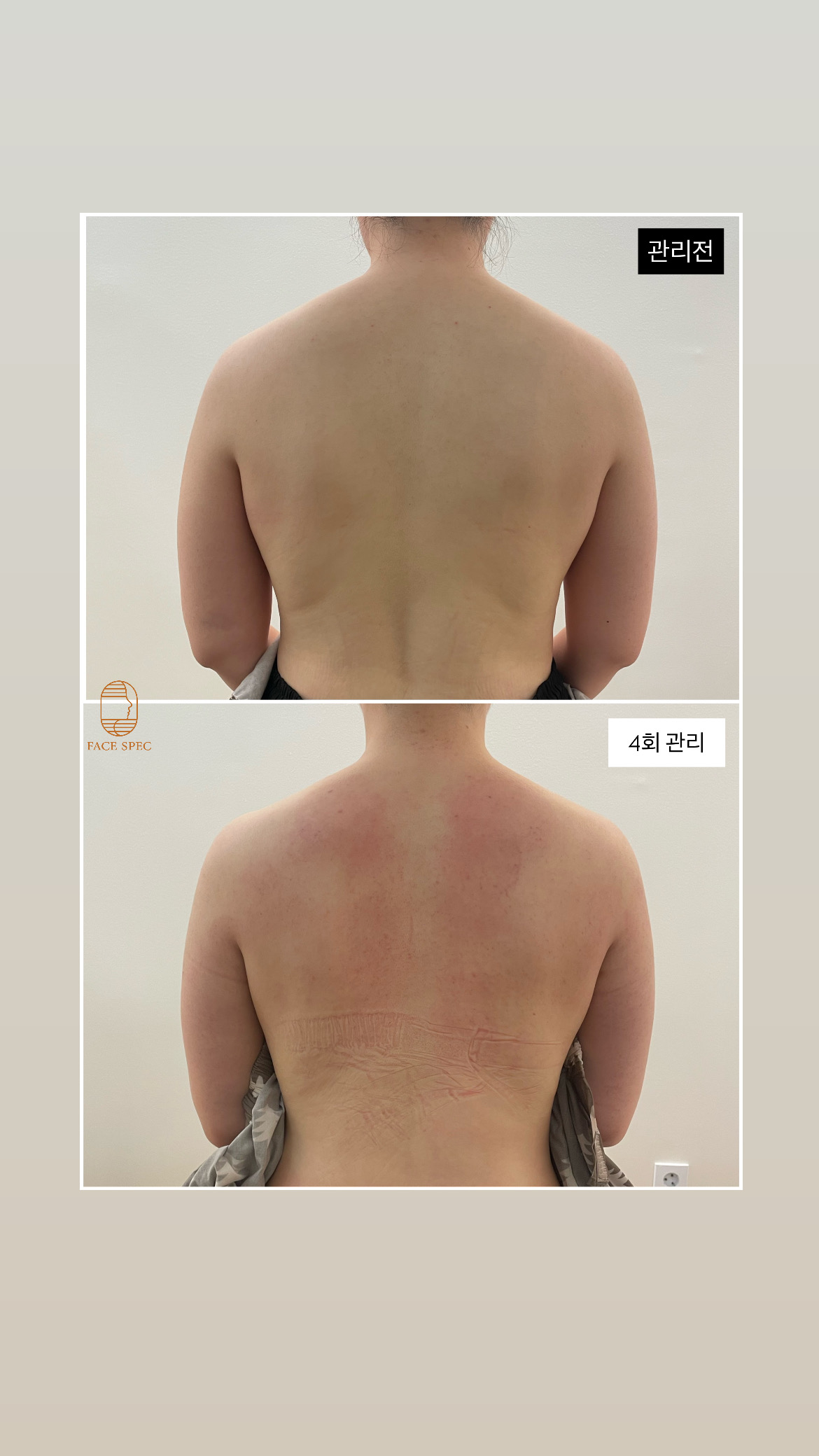 페이스펙 photo 4