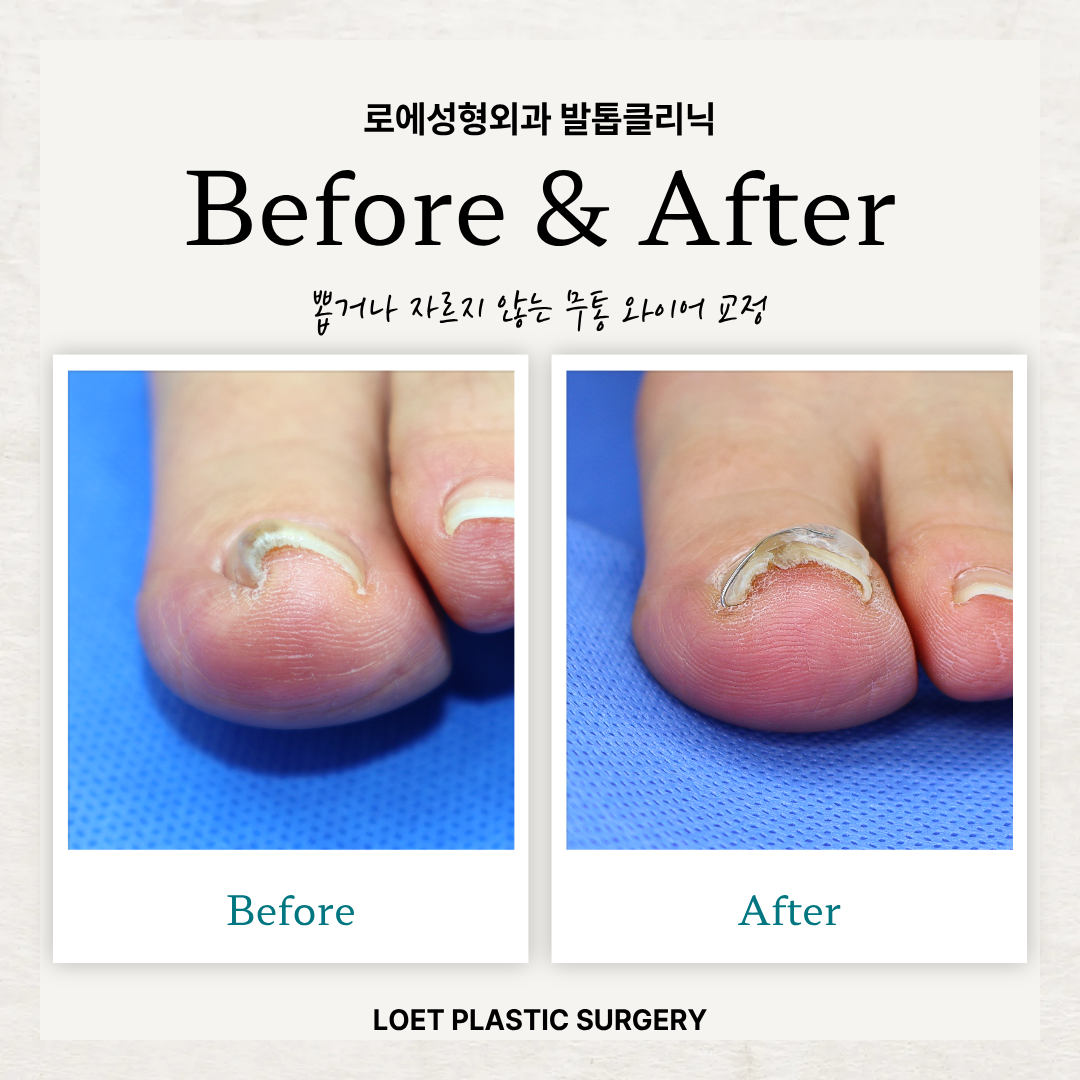 로에성형외과 이미지